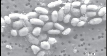 Bakterie GFAJ-1 / Credits - NASA, dr Wolfe-Simon