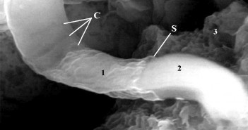 Domniemana struktura biologiczna z meteorytu Ivuna, długości ok. 0,8 um / Credits: Richard Hoover