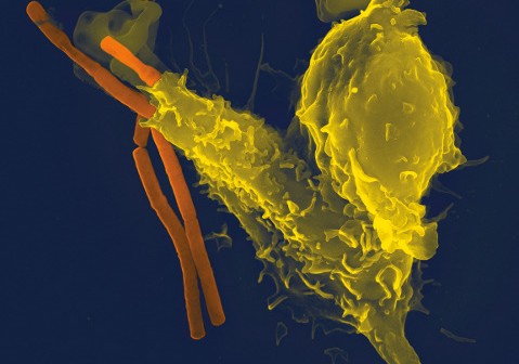 Zdjęcie przedstawia neutrofila (żółta komórka) fagocytującego pałeczki wąglika. Neutrofile to komórki układu odpornościowego, zwalczające bakterie i inne patogeny. Ich osłabienie mogłoby stanowić duże niebezpieczeństwo w trakcie kosmicznych misji załogowych. Źródło: Wikipedia; Autor: Volker Brinkmann [CC-BY-2.5 (www.creativecommons.org/licenses/by/2.5)]