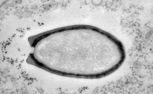 Zdjęcie przedstawia amebę zainfekowaną przez pandorawirusa. (Chantal Abergel/Jean-Michel Claverie)