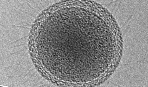 Kriogeniczny transmisyjny mikroskop elektronowy ujawnił dziesiątki wypustek przypominających fimbrie, wyrastających z komórki najmniejszej odkrytej bakterii. Prawdopodobnie służą one do pozyskiwania zasobów życiowych od innych mikroorganizmów. Pasek skali ma długość stu nanometrów. (Credits: Berkley Lab)